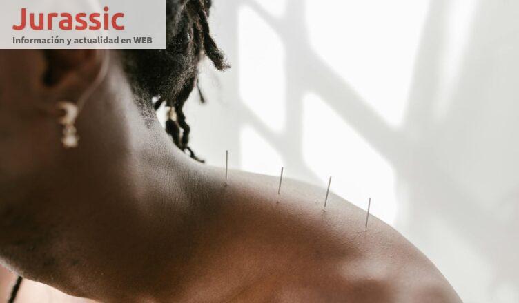 acupunctura